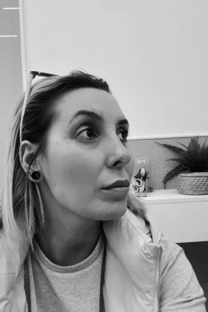 Después de una rinoplastia en Coruña – casos reales