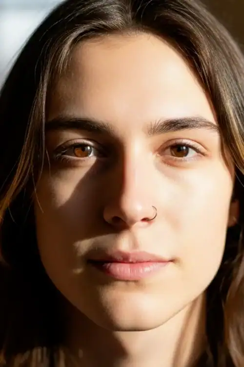 evolucion cirugia de nariz - Andres Fuertes