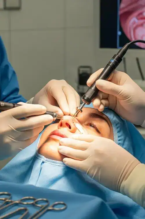 rinoplastia ultrasonica - Dr. Andres Fuertes